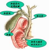 外伤性胆管损伤