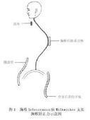 舒尔曼病