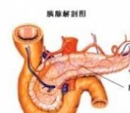 胰腺结石